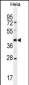 OR10H4 Antibody (C-term)